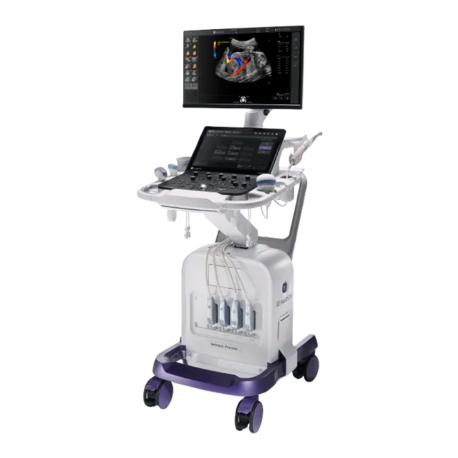 GE Healthcare Versana Prenier（エコー）
